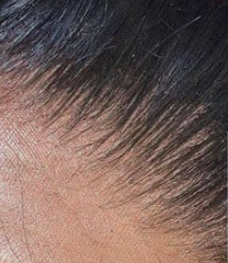 Close-up of a person's closure scalp with dark hair